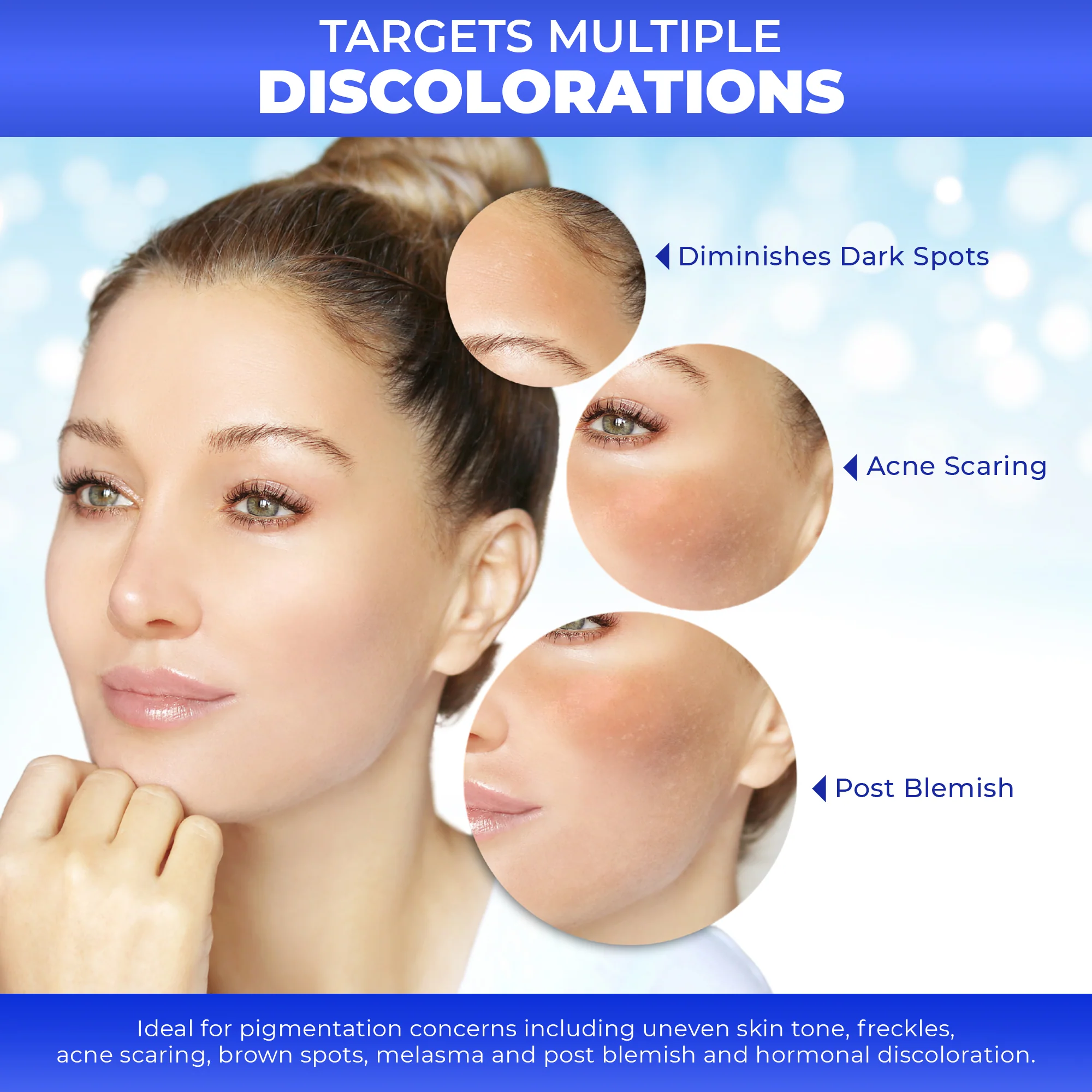 Fair & White Original Dark Spot Remover Soft Radiant Skin - Image 4