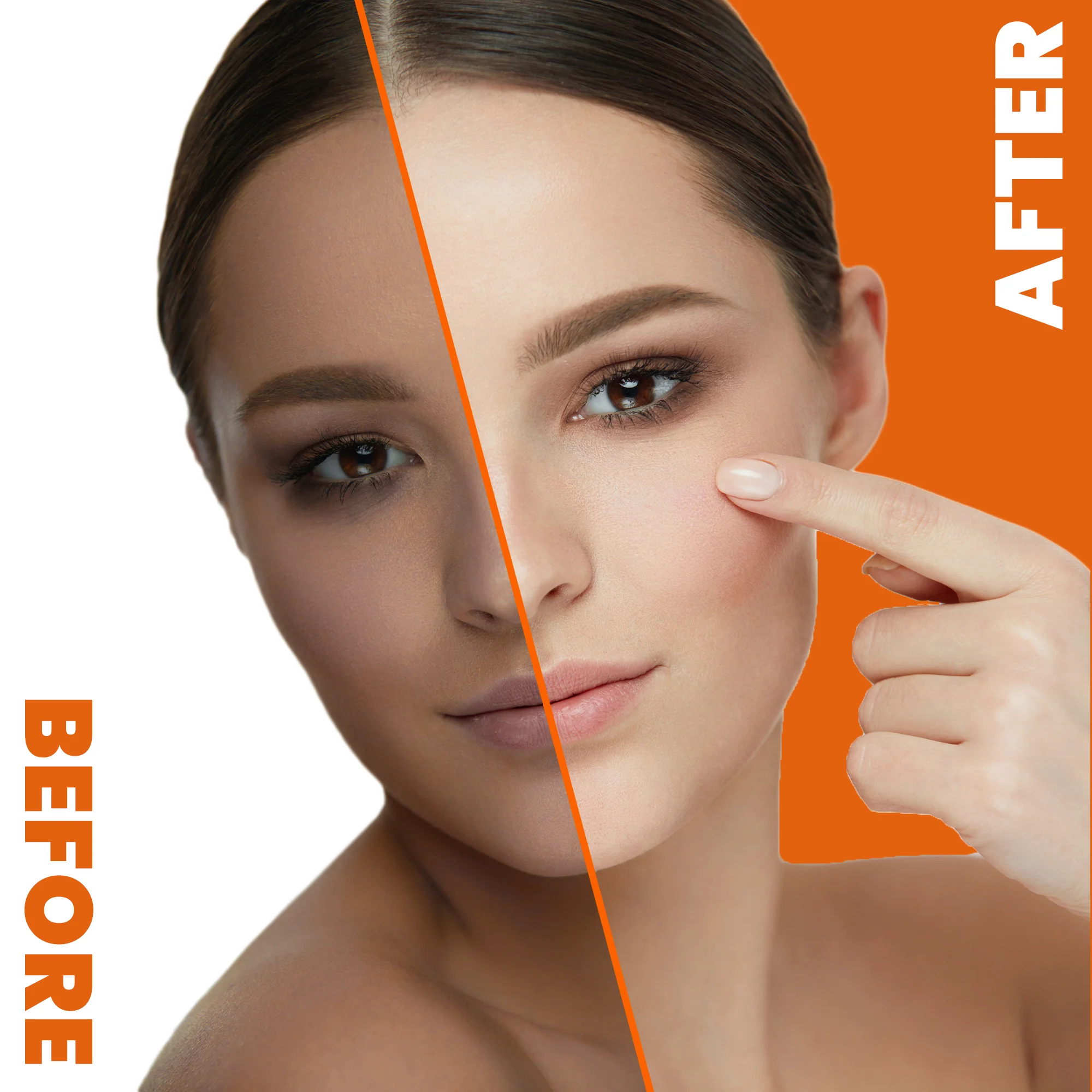 Neoprosone Brightening Gel Cream with Vitamin C – 30g / 1 Fl Oz - Image 4