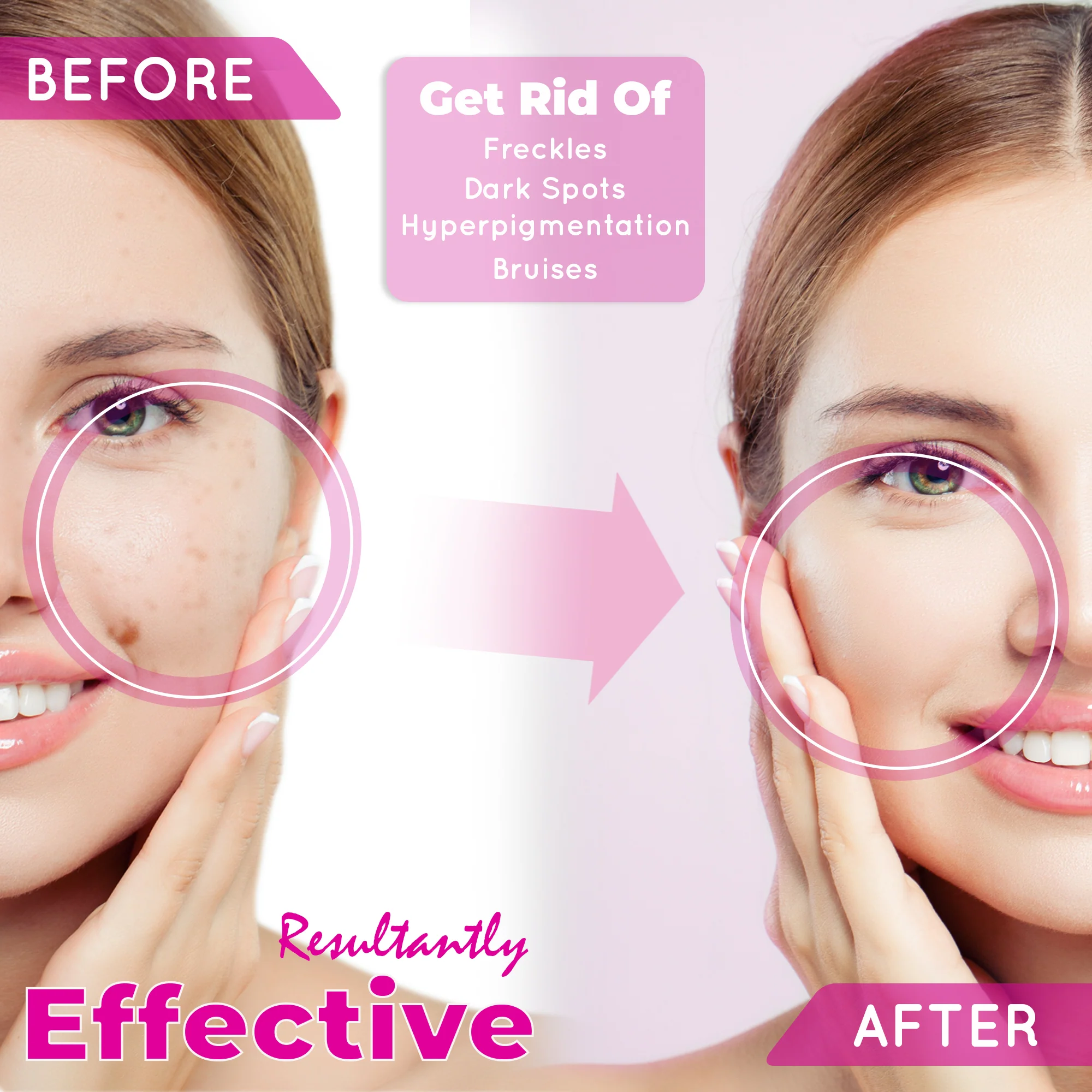 Fair And White So White Skin Perfector Dark Spot Corrector Gel 30ml / 1 fl oz - Image 4